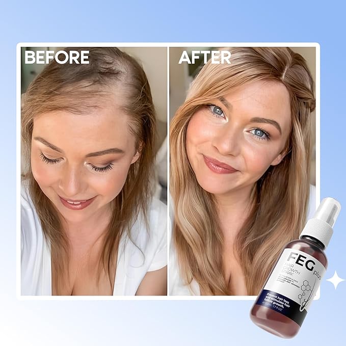 FEG Plus Organic Hair Growth Treatment Oil
